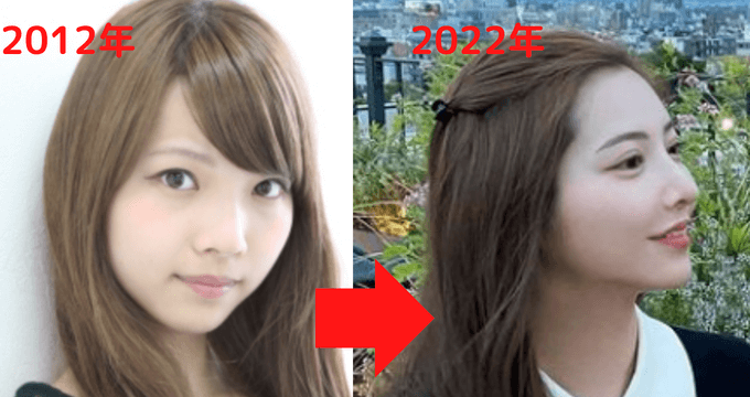 2012年と2022年尾崎美紀の鼻比較画像