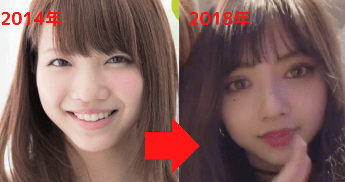 尾崎美紀の鼻変化